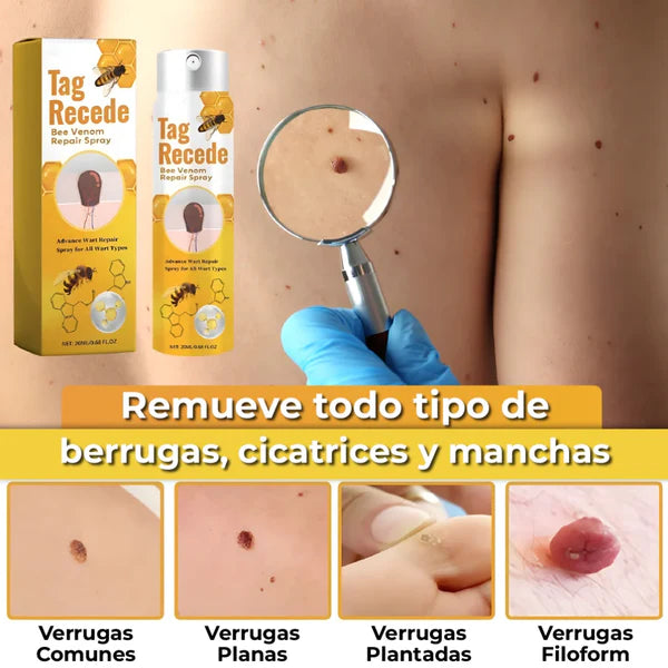 SPRAY ELIMINADOR DE VERRUGAS - TAG RECEDE ORIGINAL®