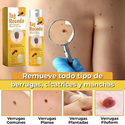 SPRAY ELIMINADOR DE VERRUGAS - TAG RECEDE ORIGINAL®